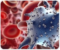 Protein linked to Parkinson's also found to drive melanoma growth